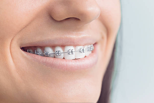 Best Dental Fillings (Composite and Amalgam)  in Avondale, LA